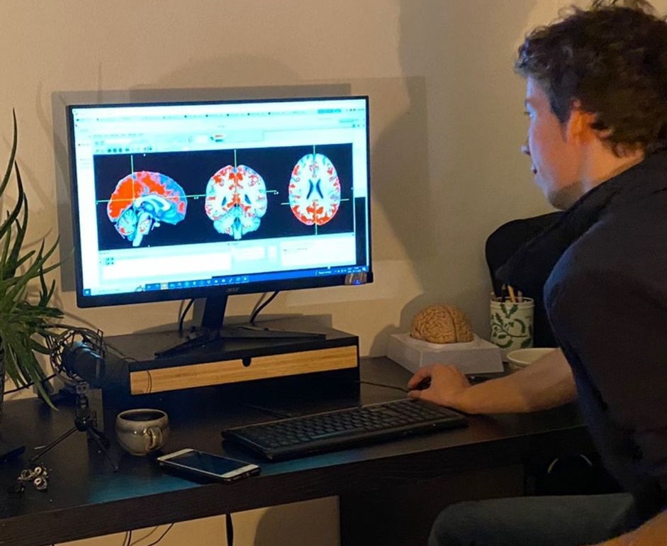 Functional Connectivity Comparison